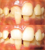 smile zone