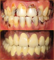 smile zone