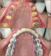 smile zone