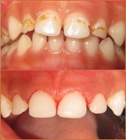 smile zone