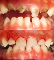 smile zone
